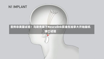 首例非美国试验！马斯克旗下Neuralink获准在加拿大开始脑机接口试验-第2张图片